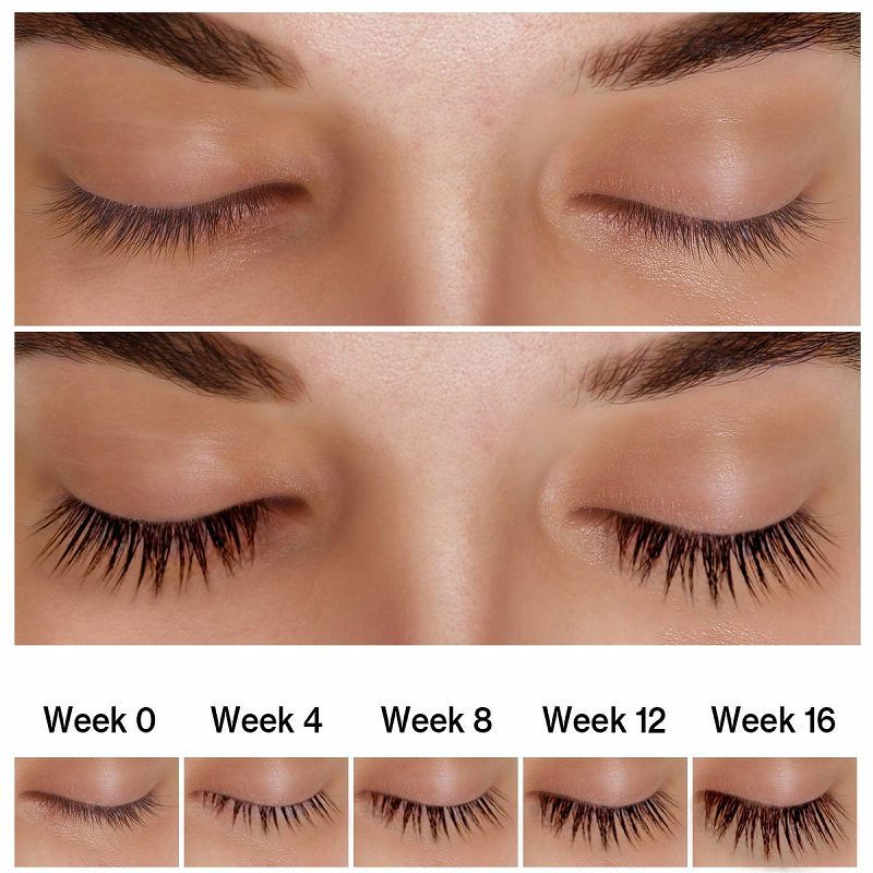 ست سرم تقویت کننده مژه و ابرو اوردینری 5 میل Multi-Peptide Lash and Brow