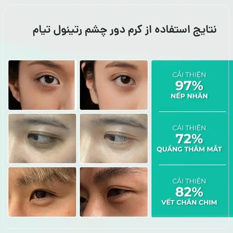 کرم دور چشم باکوچیول تیام جوانساز و لیفتینگ 30 میل Tiam – Vita A Bakuchiol Firming Eye Cream