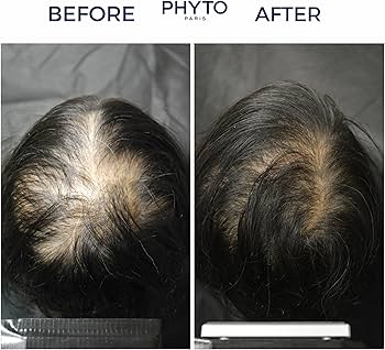 سرم فیتو ضد ریزش مدل فیتوسیان بانوان 87 درصد PHYTO PHYTOCYANE ANTI-HAIR LOSS VIAL SERUM FOR WOMEN 87%