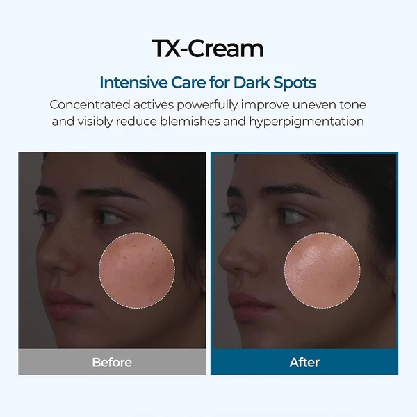 کرم ضد لک و روشن کننده ترانگزامیک اسید دکتر ملاکسین 50 گرم Dr.Melaxin TX Tranexamic Acid CREAM