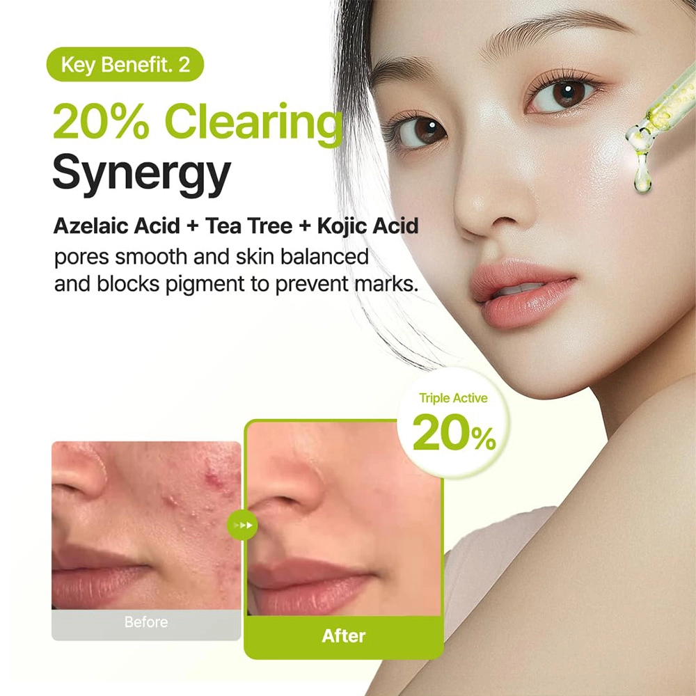 سرم آزلائیک اسید 10 درصد کوجیک اسید و تی تری پوریتو ضد لک و جوش حجم 30 میل Purito Azelaic Acid 10 Kojic Tea Tree Serum