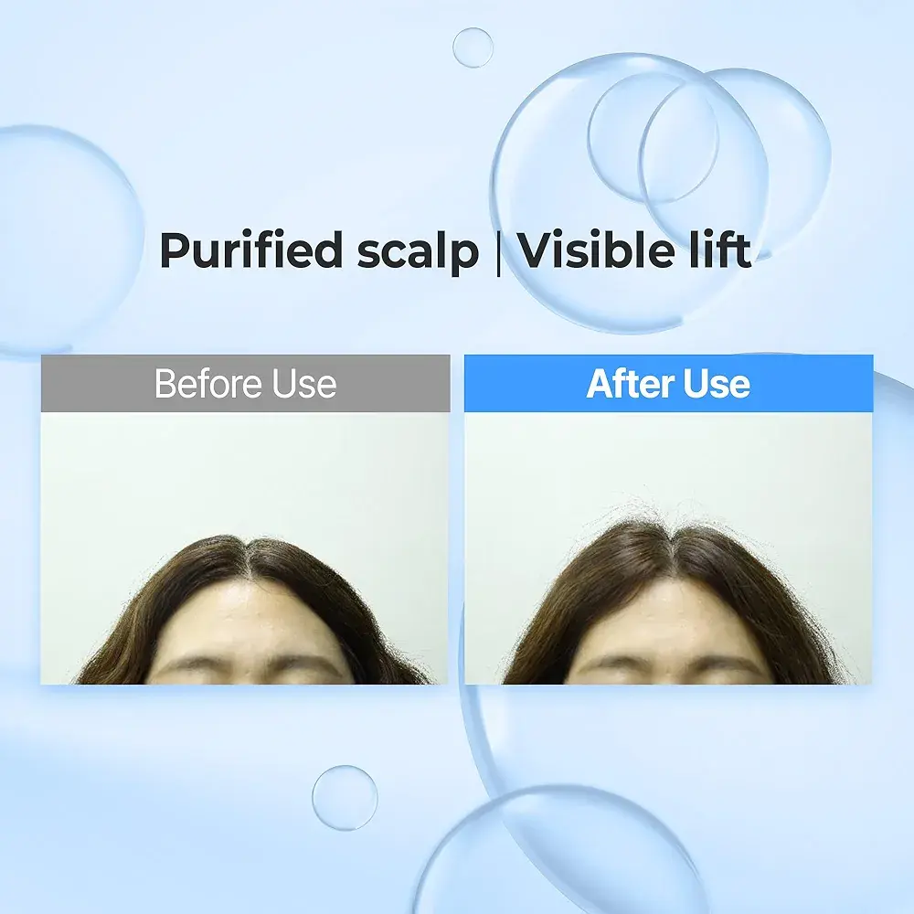 ست شامپو و ماسک مو کوندال آبرسان و حجم دهنده 300 میل KUNDAL Airy Volume Hyaluron Shampoo and Conditioner Set