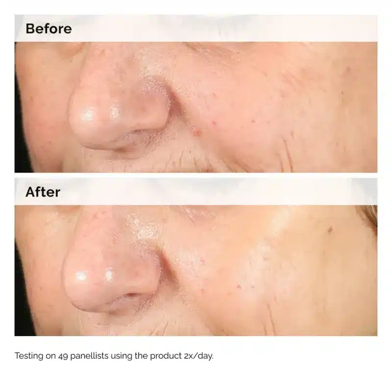 سرم آلفا آربوتین 2% اوردینری ضد لک (30mL)